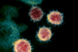 Virus SARS-CoV-2 gây bệnh COVID-19 soi trên kính hiển vi. (Ảnh: AFP/ TTXVN)